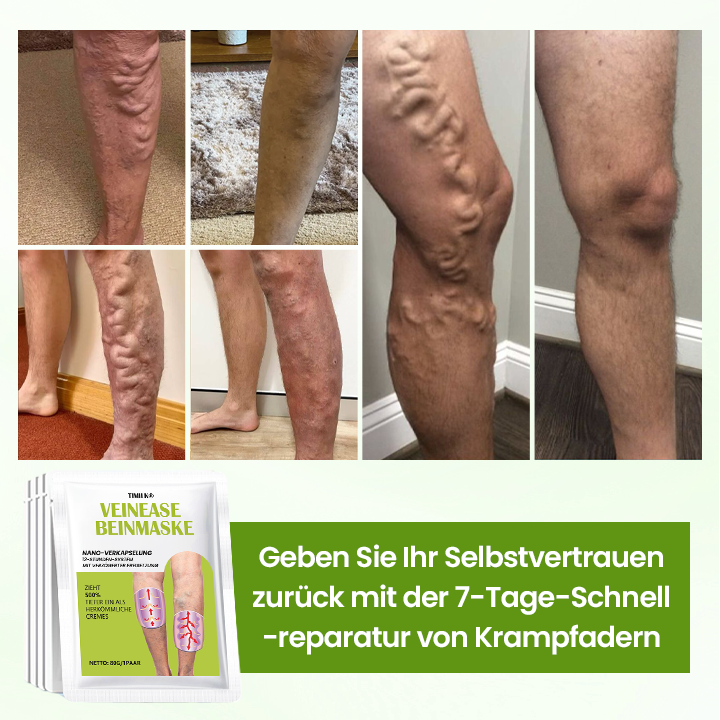 Timilk® VeinEase Beinmaske-upsell YQ