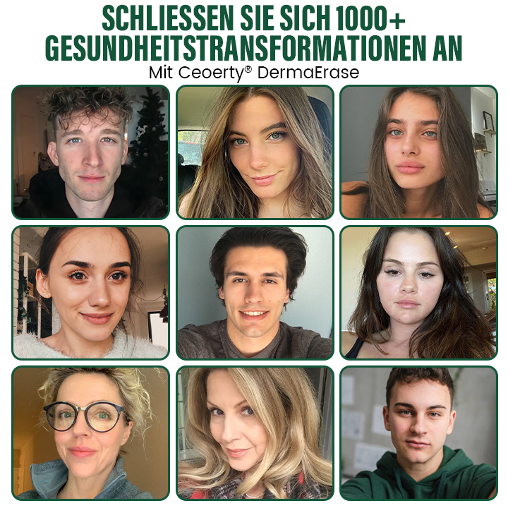 Ceoerty® DermaErase Sofort-Gel zur Entfernung von Muttermalen und Hautflecken
