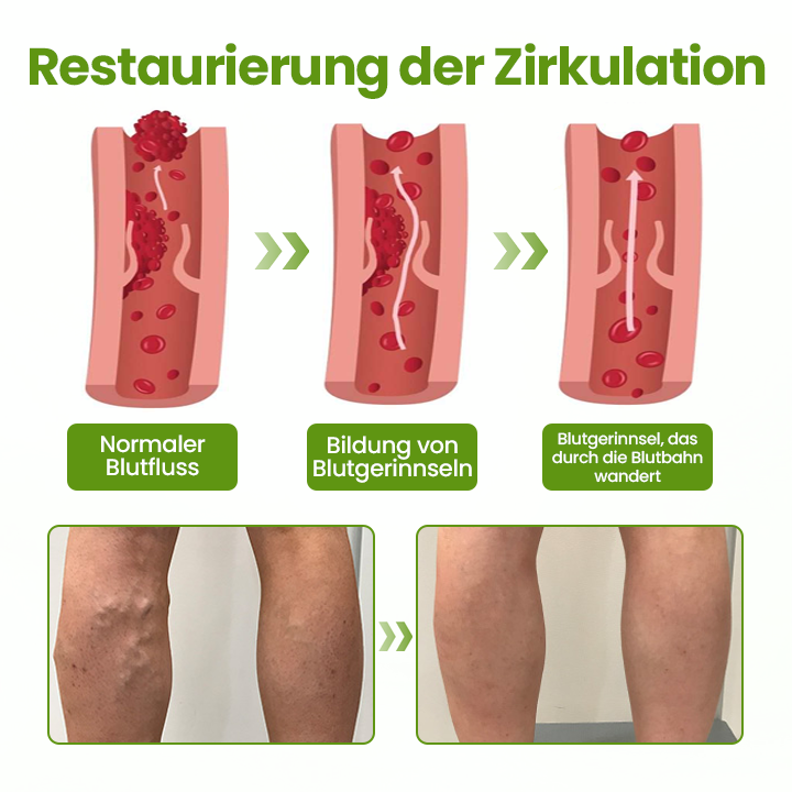 Timilk® VeinEase Beinmaske-upsell YQ