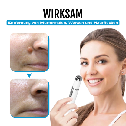 Bikenda® SpotlessDerm Molen- und Warzen-Laserstift