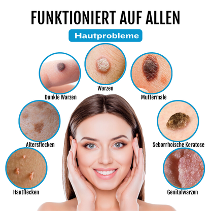 Bikenda® SpotlessDerm Molen- und Warzen-Laserstift